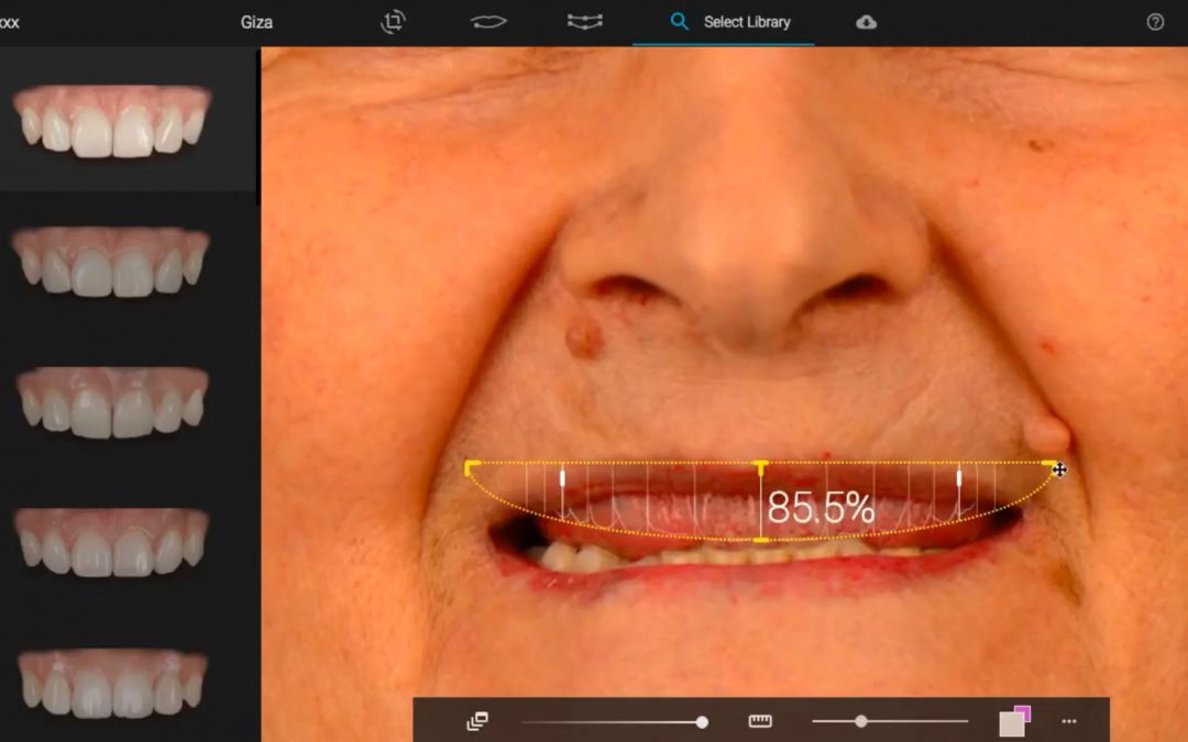 The definitive solution, chewing and smiling is possible again