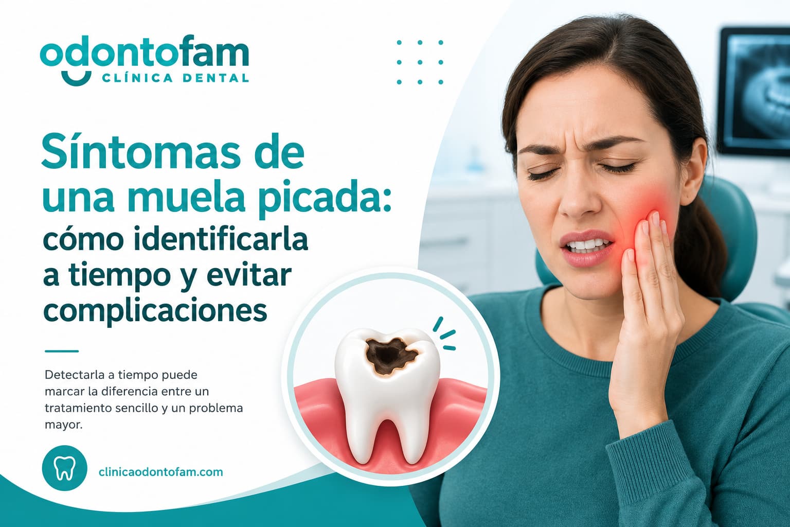 Síntomas de una muela picada: cómo identificarla antes de que el problema empeore